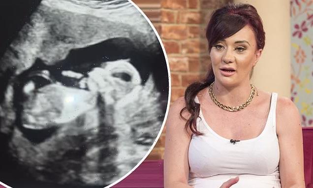 Josie Cunningham reveals she is four months pregnant