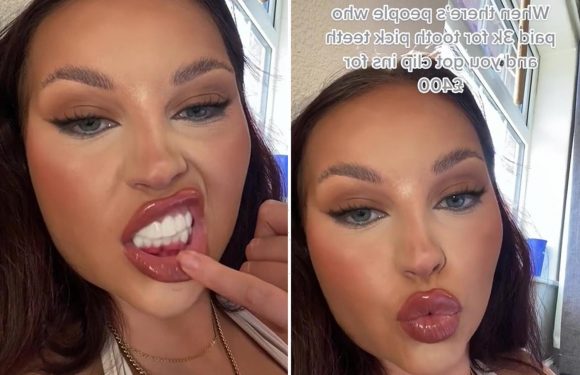 I managed to save over £2k on a set of 'veneers' – people can't tell they are fake and everyone thinks they're my teeth