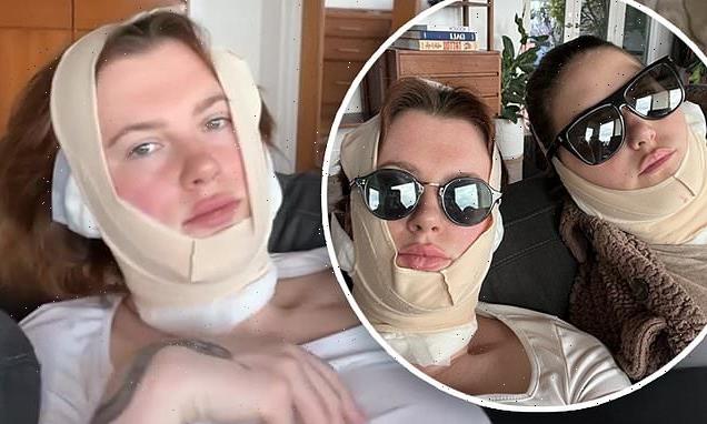 Ireland Baldwin, 26, recovers from 'mini facelift' at plastic surgeon