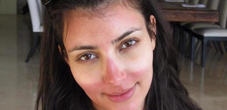 Kardashian fans love unfiltered & candid photo of Kim with severe sunburn on her face in throwback post