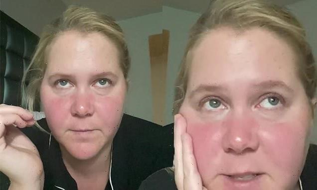 Amy Schumer cancels performance after testing positive for COVID-19
