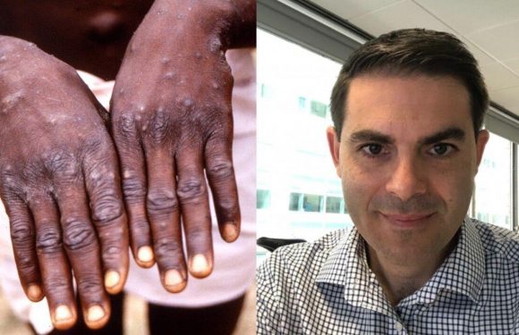 Infections expert issues warning about ‘worst ever’ Monkeypox outbreak in UK