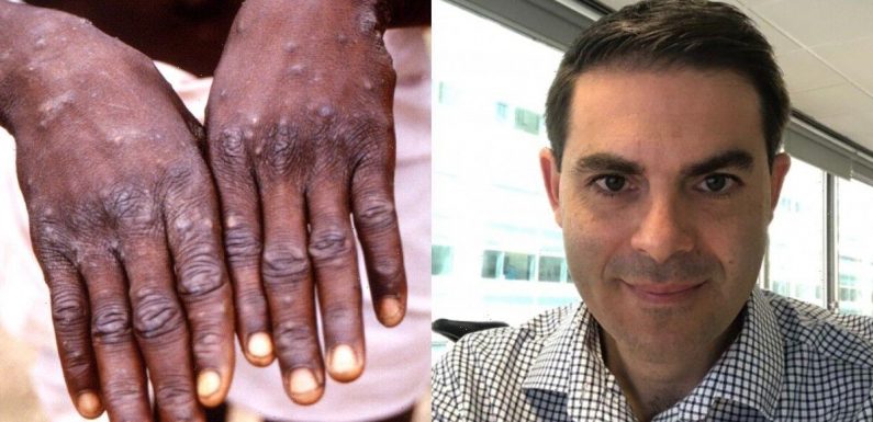 Infections expert issues warning about ‘worst ever’ Monkeypox outbreak in UK