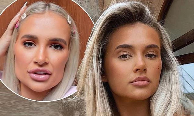 Molly-Mae Hague opens up about 'vicious circle' of topping up filler