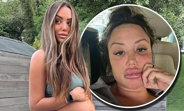 Charlotte Crosby says she is suffering from heartburn during pregnancy