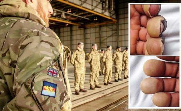 Falklands veterans face legal loophole against MoD over horror war injuries