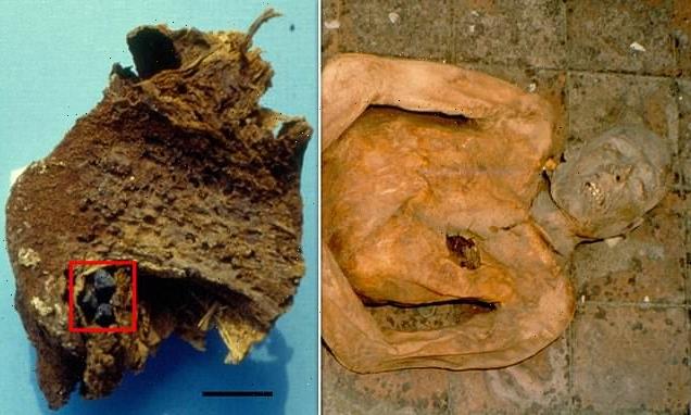 Gallstone of 400-year-old mummy used to reconstruct E. coli genome