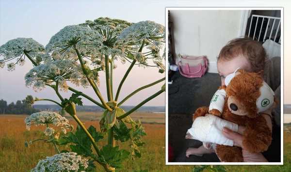 ‘Never seen a child so badly burned’ Father’s warning about UK’s ‘most dangerous plant’