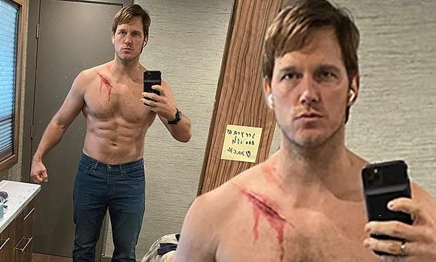 Chris Pratt displays cut abs, fake wound across his chest in selfie