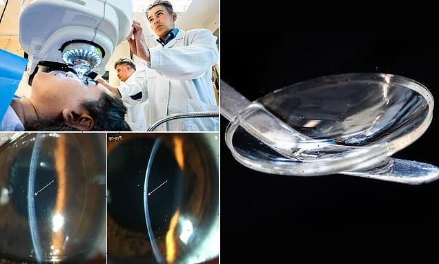 Cornea implant made of pig skin restores sight in  visually-impaired