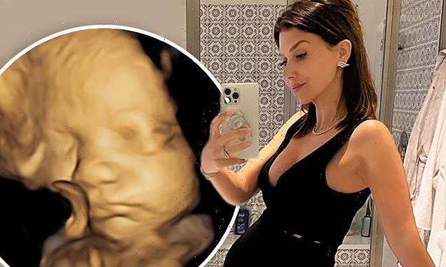 Hilaria Baldwin shares a sonogram photo and a pregnancy update
