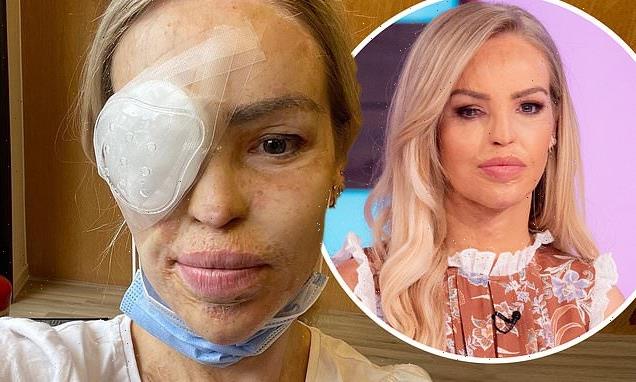 Katie Piper is rushed to emergency surgery with 'extreme pain' in eye