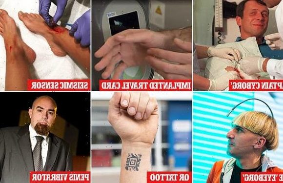 The most bizarre 'biohacks' – including man with vibrating penis