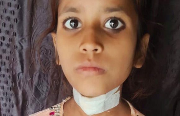 Girl, 8, miraculously survives falling onto spike that pierced through her mouth