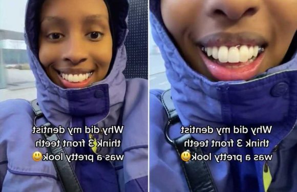 My dentist gave me three front teeth before I finally get braces but until then I look ridiculous | The Sun