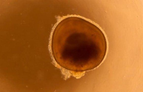 Scientists create 'mini eyes' in the lab