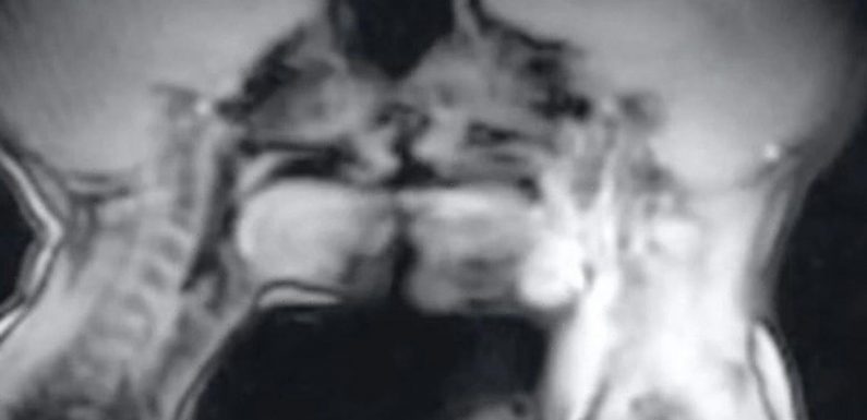 Couple had sex in an MRI scanner and it shows how penis becomes a ‘boomerang’
