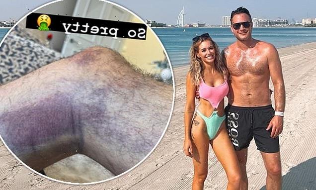 Gary Lucy reveals shocking injuries from his Boxing Day car smash