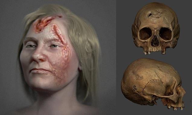 Icelandic woman's face was ravaged by SYPHILIS 500 years ago