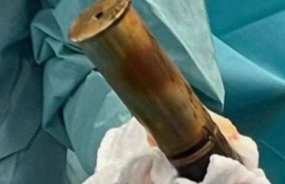 Kids’ ward evacuated after pensioner shows up at A&E with WW1 bomb up his a*se