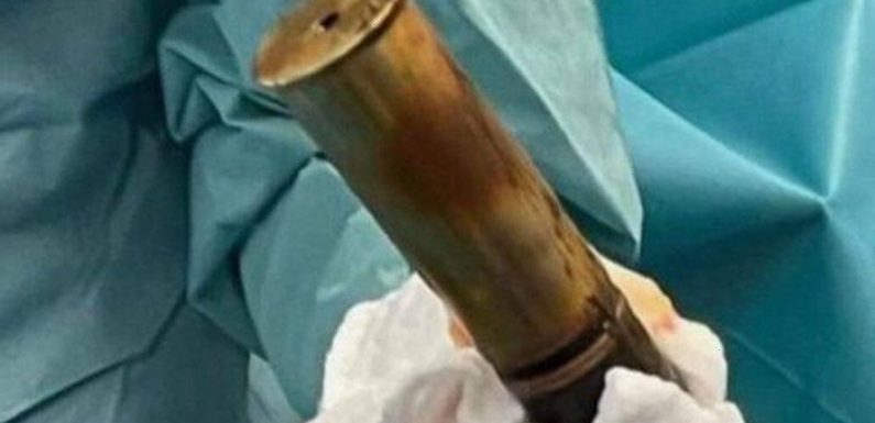 Kids’ ward evacuated after pensioner shows up at A&E with WW1 bomb up his a*se