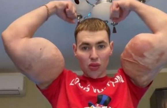 Russian ‘Popeye’ bodybuilder sparks concern as he admits ‘problems in his head’