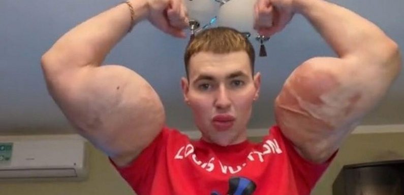 Russian ‘Popeye’ bodybuilder sparks concern as he admits ‘problems in his head’