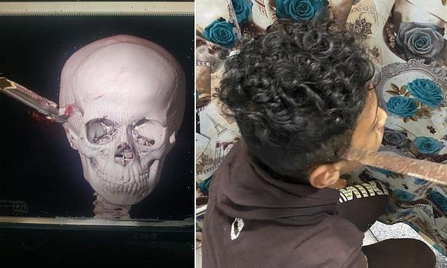 Schoolboy stabs classmate through skull with a metal file in Egypt