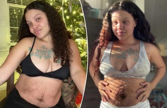 Trolls slam my mum bod and tell me I need surgery but I don't care what people think, this is what motherhood looks like | The Sun