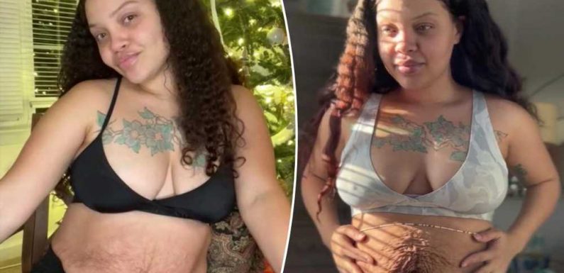 Trolls slam my mum bod and tell me I need surgery but I don't care what people think, this is what motherhood looks like | The Sun