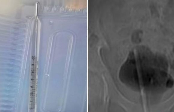 Boy, 12, undergoes horror surgery after shoving entire thermometer up his penis