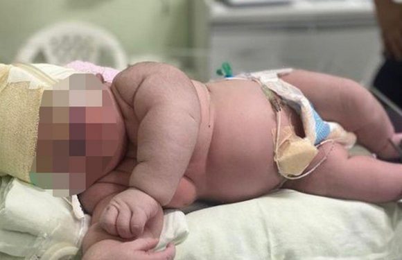 Docs stunned after delivering huge 7kg baby that’s the size of a one-year-old