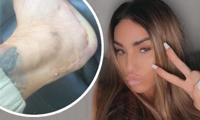 Katie Price shares gruesome update on her troublesome foot injury