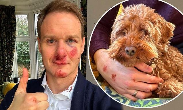 Dan Walker says his body is 'still aching' after horror crash