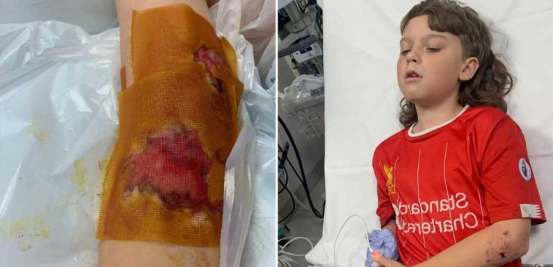 My son, 10, was savaged by out-of-control dog while playing football | The Sun