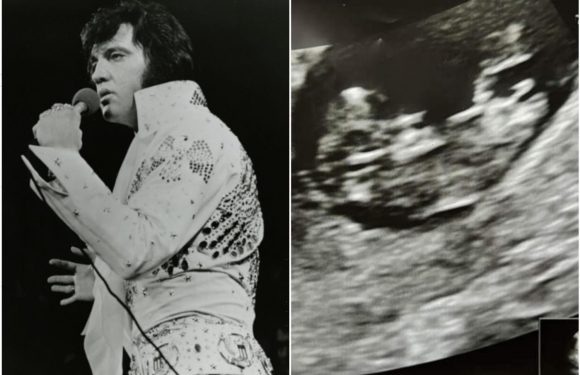Scots gran spots Elvis Presley in grandchild's ultrasound – can you see it? | The Sun