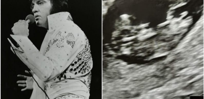 Scots gran spots Elvis Presley in grandchild's ultrasound – can you see it? | The Sun
