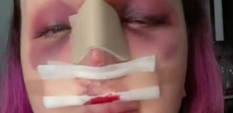 I’m on the way to getting my dream nose but no one prepared me for how savage surgery is – I feel like I’m drowning | The Sun