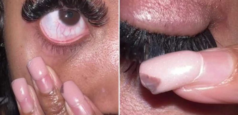 Beauty fan questions if she's had a reaction to her lash extensions, but people are more concerned about another issue | The Sun