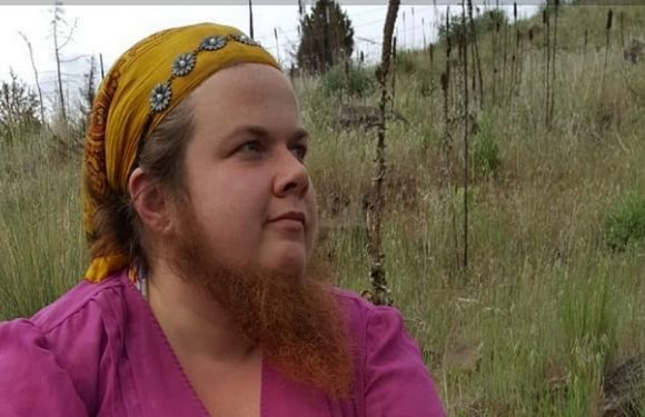 Woman with ‘world’s longest beard’ had facial hair set alight by abusive partner