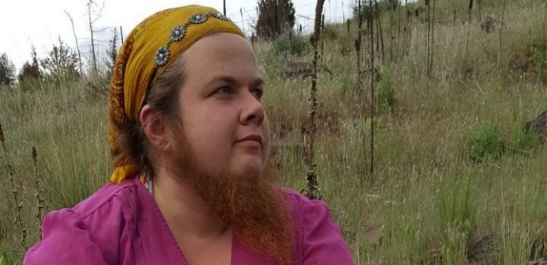 Woman with ‘world’s longest beard’ had facial hair set alight by abusive partner