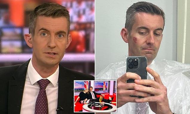 BBC Breakfast host suffers 'messed-up face' in horrific bike accident