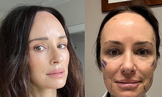 Ex-E! News host Catt Sadler details facelift at age 48