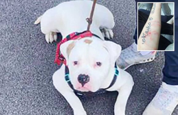 Girl, 17, 'lucky to have arms' after being attacked by out-of-control dog when beast went berserk in park | The Sun