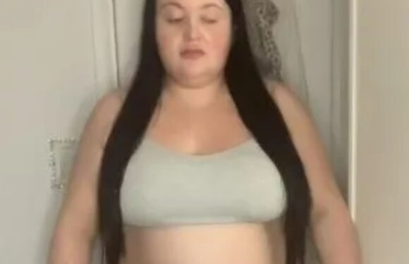I forked out for a gastric sleeve and people always say the same thing when they see my before and after pictures | The Sun