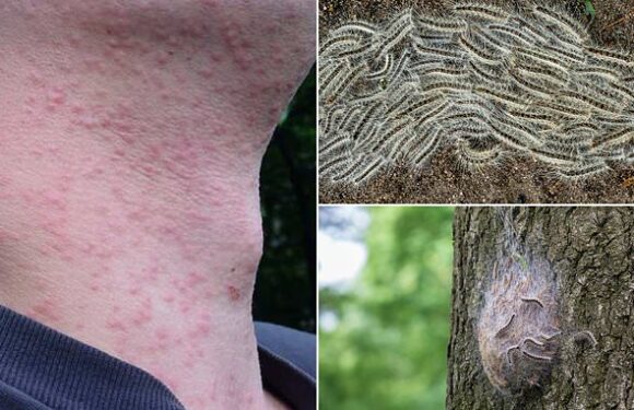 Toxic caterpillars that cause rashes hit the UK – how to spot them