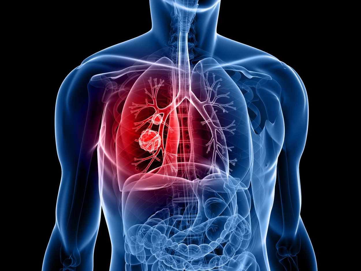 Eating breakfast fave could 'slash your risk of killer lung cancer' | The Sun