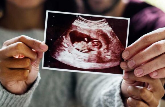 What is nub theory and does it work at 12 weeks? – The Sun | The Sun