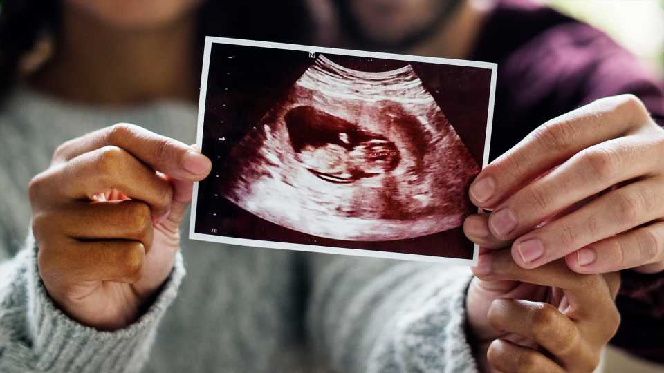 What is nub theory and does it work at 12 weeks? – The Sun | The Sun