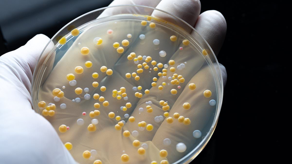 Air pollution is linked to a rise in antibiotic resistance, study says